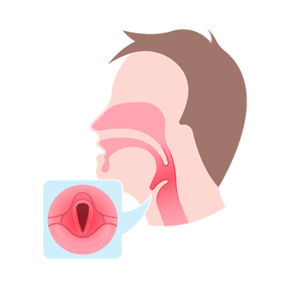 Faringitis