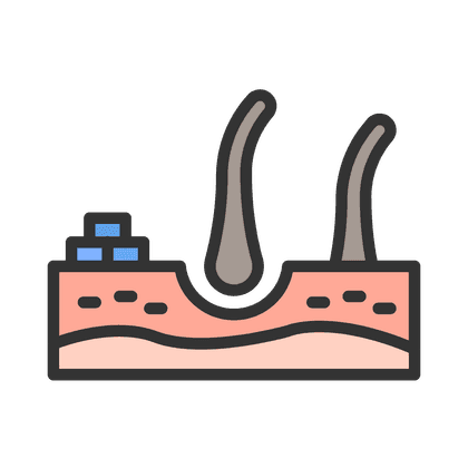 Seborrea